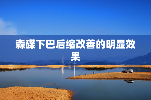 森碟下巴后缩改善的明显效果