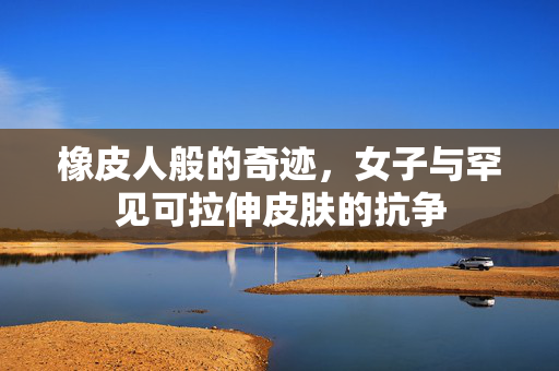 橡皮人般的奇迹，女子与罕见可拉伸皮肤的抗争