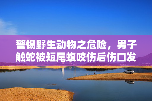 警惕野生动物之危险，男子触蛇被短尾蝮咬伤后伤口发黑事件